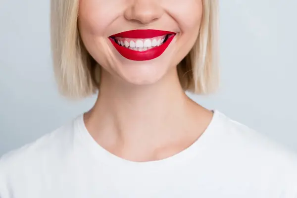 Close Cropped Photo Positive Cheerful Girl White Beaming Bleaching Smile — Stock Photo, Image