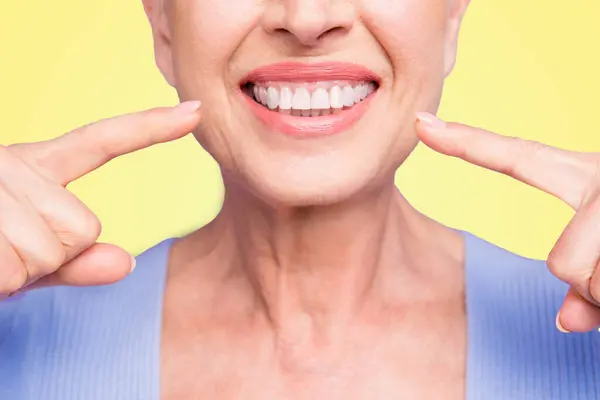 有强壮健康的直白色完美牙齿的概念在晚年 裁剪的笑容微笑的女性领取养老金的女人指着她的牙齿 孤立的紫色背景 — 图库照片