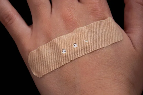 Adhesive plaster or bandage on hand