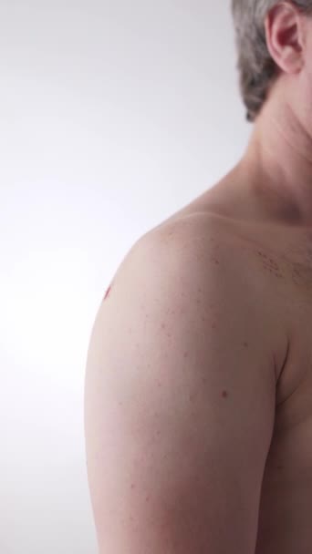 Lékařskou Péči Technologie Traumatologické Chirurgie Pacient Kůže Zblízka Zotavení Ramene — Stock video