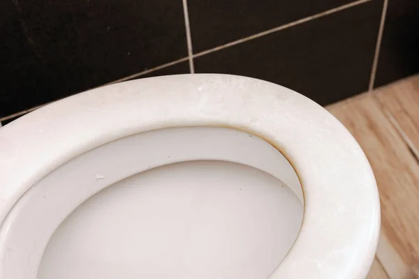 Špinavé Nechutné Toliet Víko Zblízka Spousta Bakterií Nehygienických Nutná Úklidová — Stock fotografie