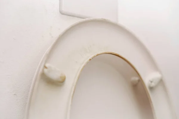 Dirty Disgusting Toliet Lid Close View Lot Bacteria Unsanitary Cleaning — Stock Photo, Image