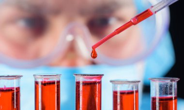 Kan testi. Doktor laboratuvarda hastanın kan örneğiyle çalışıyor. Serolojik test. Tıbbi bilimci ya da laboratuvar asistanı test tüplerindeki kan örneklerini inceliyor. Pipette kan damlası, seçici odaklanma