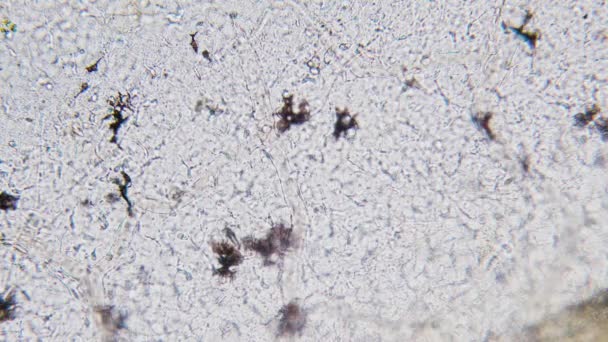 Bluterythrozytenbewegung Den Blutgefäßen Kapillaren Pigmentzellen Mikroskopie Kaulquappenschwanz — Stockvideo
