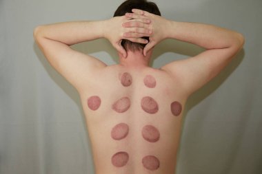 Genç adam gri arka planda vakum masajının sonuçlarıyla geri döndü. Süpürge masaj tekniği, vakum masajından sonra izler.