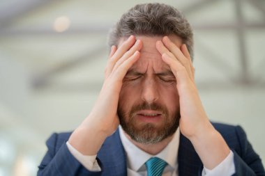 Baş ağrısı konsepti. Cephalalji ve migren. Sinüs ağrısı, gerilim ya da küme baş ağrısı olan bir adam. Baş ağrısı, migren belirtileri. Kronik baş ağrıları. Baş ağrısı tetikleyiciler
