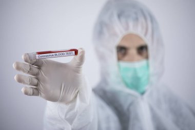 Doktorun elinde koronavirüs testi için bir tüp kan var.