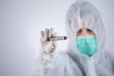 Doktorun elinde koronavirüs testi için bir tüp kan var.
