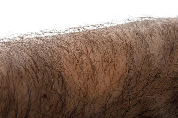 Część Ludzkiego Ramienia Włosami Wyizolowana Białym Tle — Zdjęcie stockowe