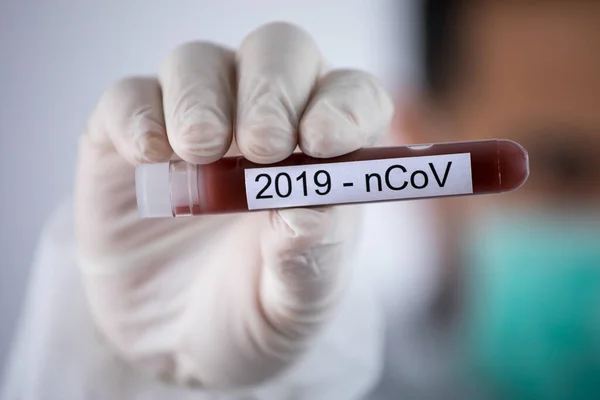 Doctor Holds Test Tube Blood Coronavirus Test — Stock Photo, Image