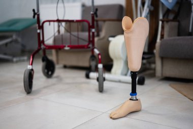 Yürüyen bir adamın yanında bir rehabilitasyon merkezinde duran protez bacak, modern sağlık hizmetleri teknolojisi aracılığıyla iyileşme ve hareketlilik desteğini sembolize ediyor..