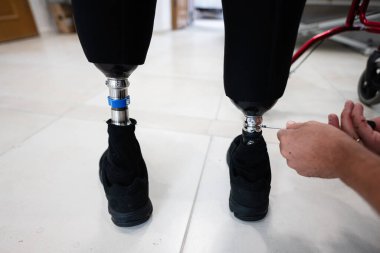 Bir teknisyenin protez bacaklara ayarlamalar yapması, rehabilitasyon ortamında hassasiyet ve özen göstermesi. Görüntü yenilikleri ve kişisel tıbbi desteğin önemini aktarır.