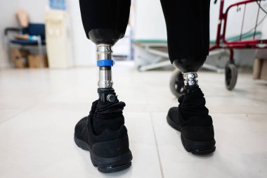 Siyah spor ayakkabılarla donatılmış protez bacakların detaylı bir görüntüsü, hareket kabiliyeti ve modern protez teknolojinin kapalı alanlarda vurgulanması.