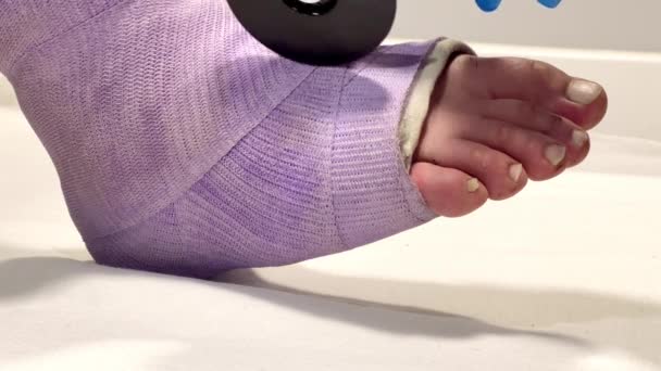 Крупним Планом Ногу Загорнуту Фіолетову Пов Язку Відкритими Пальцями Ніг — стокове відео
