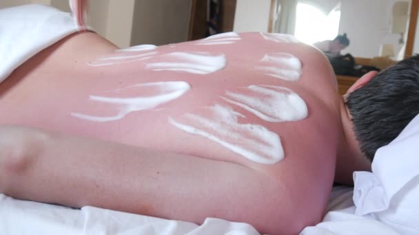 肌に日焼け ホテルのベッドに寝そべっている男の背中と肩の赤い日焼けした肌 抗火傷薬パンテノールを適用する女性 — ストック動画