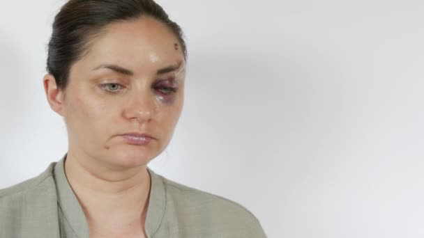 一个年轻女人眼睛下面的大的真正的瘀伤血肿 新鲜的紫色瘀伤和来自打击的额头划伤 面对家庭暴力受害者吓得面无血色 — 图库视频影像