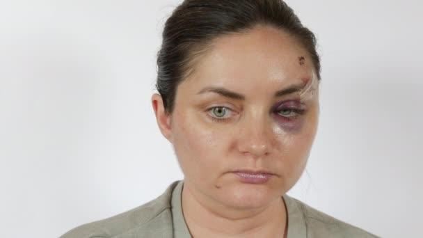 若い女性の目の下に大きい本物のブルーズ血腫 新鮮な紫色の傷および打撃からの額の傷 家庭内暴力被害者の恐ろしい顔 閉じた白い背景 — ストック動画