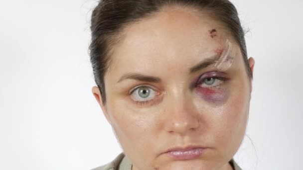 一个年轻女人眼睛下面的大的真正的瘀伤血肿 新鲜的紫色瘀伤和来自打击的额头划伤 面对家庭暴力受害者吓得面无血色 — 图库视频影像