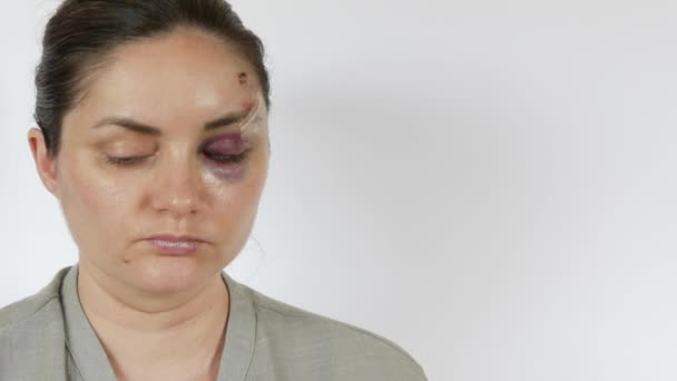 若い女性の目の下に大きい本物のブルーズ血腫 新鮮な紫色の傷および打撃からの額の傷 家庭内暴力被害者の恐ろしい顔 閉じた白い背景 — ストック動画