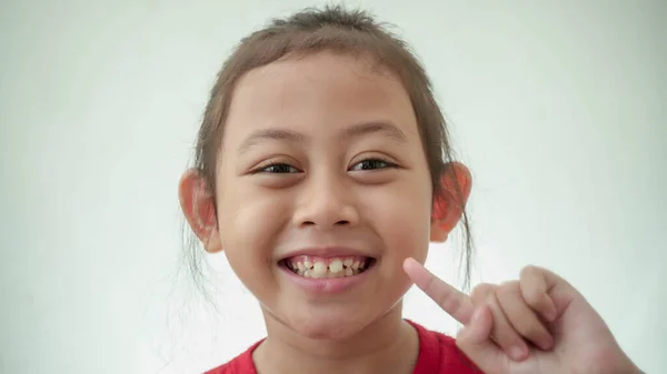 Happy Asian Child Red Showing Her Decayed Teeth Selective Focus — Stock Photo, Image
