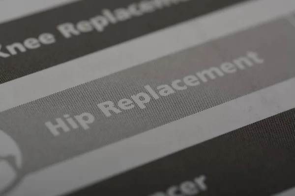 Close up view of the word HIP REPLACEMENT. A hip replacement, also known as hip arthroplasty, procedure in which a damaged or diseased hip joint is replaced with an artificial joint