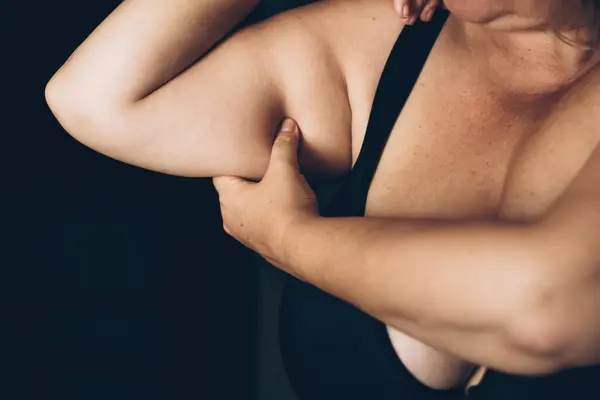 Body Positivity: Womans gentle arm pinch. Close-up of woman pinching her upper arm, body-positive statement embracing natural skin texture and self-love.