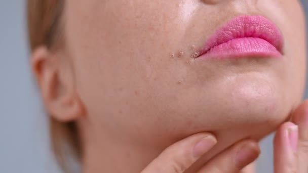 Ung Kaukasisk Kvinna Återfuktar Ansikte Och Hud Med Kosmetisk Olja — Stockvideo
