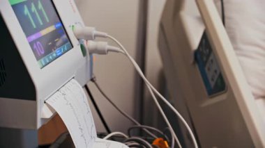 Bir doktorun muayenehanesindeki fetüs monitörünün yakın çekimi, doğum öncesi kontroller sırasında fetüsün kalp atış hızını ve rahim kasılma verilerini gösteriyor.