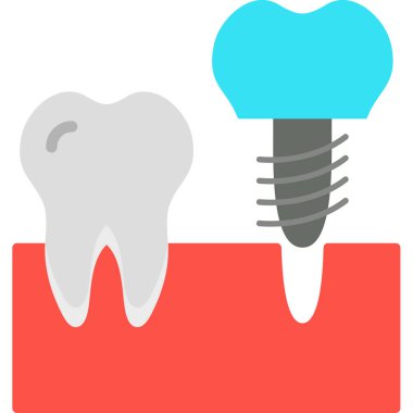 Dental Implant vektör simgesi