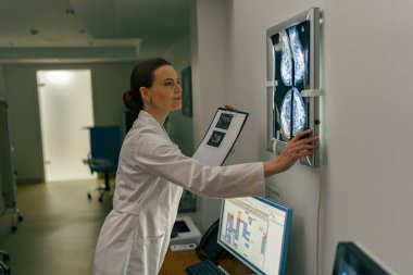 Kadın doktor nörolog hastanede beyin taraması görüntülerini analiz ediyor. Yüksek kalite fotoğraf