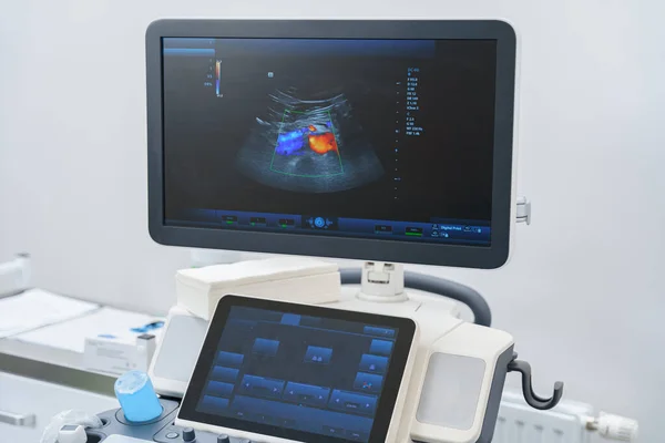 Orvosi Ultrahang Diagnosztikai Gép Készen Áll Munkára Modern Kórházban Kiváló — Stock Fotó