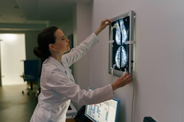 Kadın doktor nörolog hastanede MRI görüntülerini analiz ediyor. Yüksek kalite fotoğraf