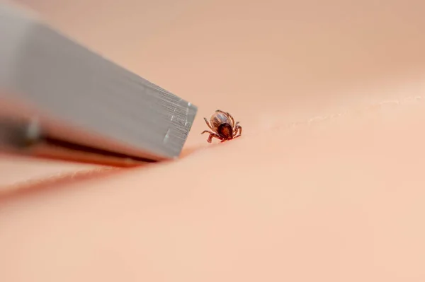 The tick is removed with tweezers from the baby\'s skin. Concept: tick bite, danger of disease.