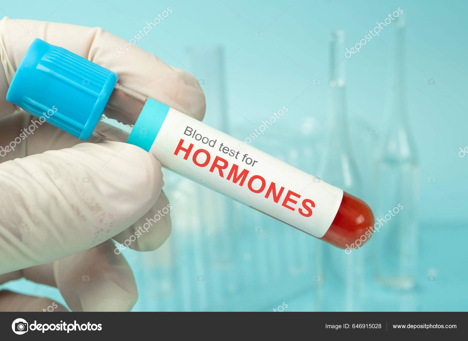 Blood Sample Study Levels Hormone Tests Doctor Holding Blood Tube Stock