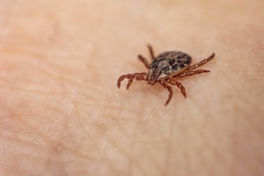 Tehlikeli bir kan emici böcek. Küçük kahverengi benekli mayt, biyolojik adı Dermacentor marginatus insan derisi üzerinde. Deri altyapısında tik tak. makro fotoğraf