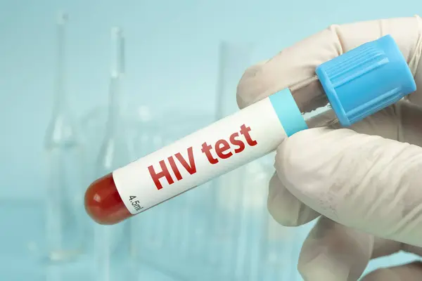 Hand Holding Blood Sample Hiv Test Blue Laboratory Background — Stock Photo, Image