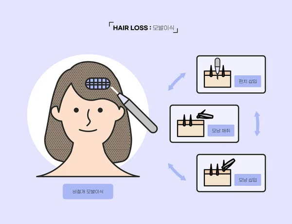 Hair Loss Concept Vector Illustration — Stock Vector