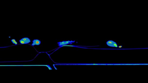 Siyah Arka Planda Sakallı Bir Ejderhanın Tomografisi Onkolojist Veteriner Ray — Stok video