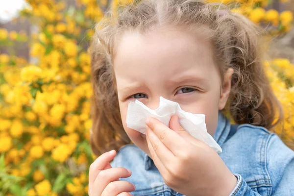 Allergy to plants in a child. Runny nose and tears.