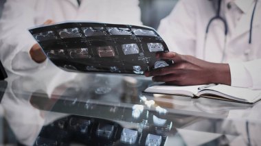 Erkek doktorlar ve resepsiyondaki bir hasta beyin röntgenini tartışıyorlar..