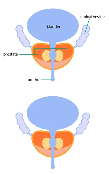 Illustration Depicting Bladder Prostate — Διανυσματικό Αρχείο