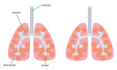Illustration of anatomy of the lungs
