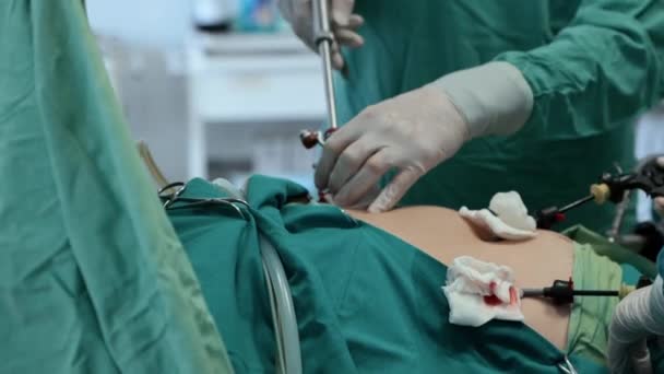 Operation Nahaufnahme Der Chirurgischen Hände Chirurgisches Behandlungskonzept Medizinische Hände Operieren — Stockvideo