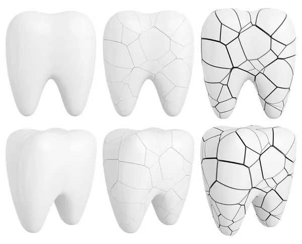 Dientes Blancos Brillantes Fracturados Elementos Diseño Odontología Imagen Renderizada — Foto de Stock