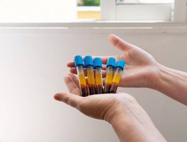 Ellerinde kan tüpleri olan eller. Kopyalamak için boşluk.