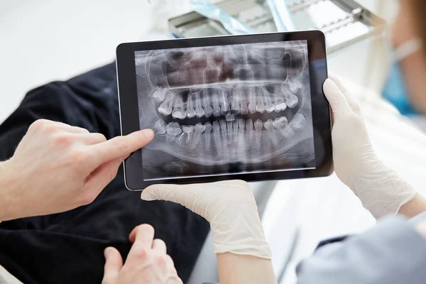 Kapalı kadın dişçi elinde hasta ağzı dijital film tutuyor. Kadın doktor hasta ağız taraması gösteriyor.