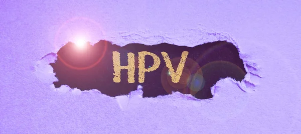 Ręczne Pisanie Znaku Hpv Business Concept Grupa Wirusów Które Wpływają — Zdjęcie stockowe