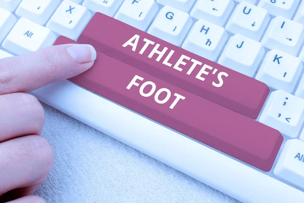 Szöveg Felirat Bemutató Sportolók Foot Word Írt Egy Gombás Fertőzés — Stock Fotó