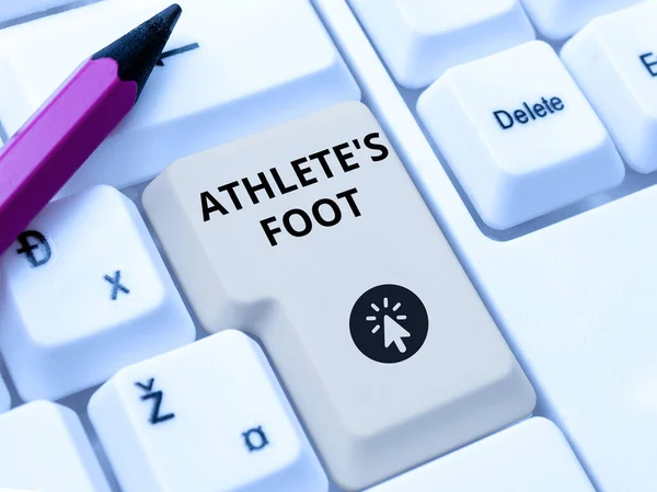 Kézírás Szöveg Sportolók Láb Üzleti Megközelítés Gombás Fertőzés Láb Jelölt — Stock Fotó