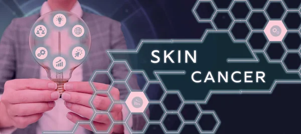 Text Zeigt Inspiration Hautkrebs Geschäftsansatz Unkontrolliertes Wachstum Von Abnormalen Hautzellen — Stockfoto